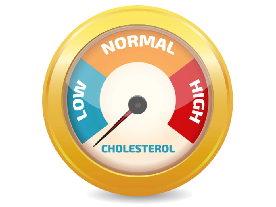 The Connection Between Cholesterol Levels and Stroke Risk